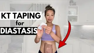 How to apply Kinesio (KT) Tape if you have Diastasis Recti (Pregnancy and Postpartum)