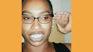 Vlog #1: Adult Braces Update: 4 Days In... It's bad but I'm alive