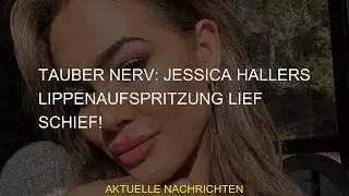 #Fotos #Hallers #Star #News #Lippenaufspritzung #schief #Starbilder #Stars #Klatsch #Promis #Nerv #B