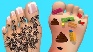 Foot Clinic - Gameplay Walkthrough - All Levels (IOS, Android)
