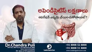 అపెండిసైటిస్ లక్షణాలుఆపరేషన్ ఎప్పుడు చేయించుకోవాలంటే? | Dr. Chandra Shekhar Puli |London Gastro Care