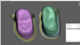 Meshmixer - Advanced Crown Design (Emergence Profile Technique)