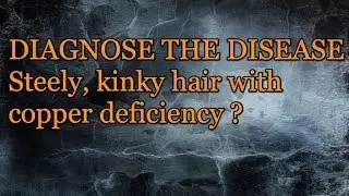 QUICK QUIZ