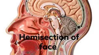 Hemisection of Face || #anatomy #anatomyclass #hemisection of face #bds1styear #bds
