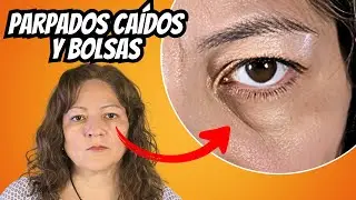 La soluci&oacute;n quir&uacute;rgica a los ojos envejecidos