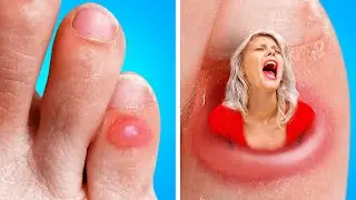 ALL PAIN in ONE VIDEO! If Pain Were People! WEIRD Pranks, DIYs and Hacks