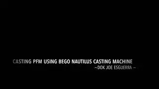 Casting PFM using BEGO Nautilus Casting Machine by Dok Joe Esguerra