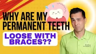 Why Are My Teeth Loose with Braces??