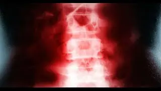 Denver Low Back Pain Relief | Back Pain Doctor Shares the #1 Drink You Must Avoid