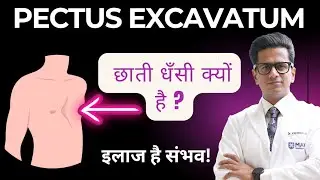 Pectus Excavatum क्या है? छाती धँसने की बीमारी का इलाज | Dr Kamran Ali