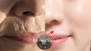 وداعاً للبقع والتجاعيد‼️السر الذي لا يخبرك به أطباء التجميل عن نضارة البشرة.