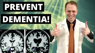 Dementia Prevention, Causes, Risk Factors, Genetics, Clinical Trials, Future Research