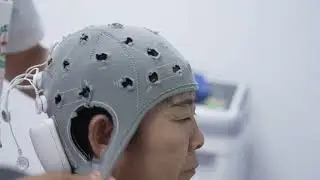 Brain Computer Interface Tech Benefits Patients in Sichuan China