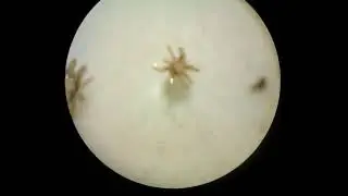 A male and two females of Meristaspis lateralis from the Egyptian fruit bat, Rousettus aegyptiacus