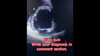 #cardiology #echocardiography #heartscan #echo #hearttest @SafaMedicalLecture