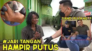 NG3R! 😭‼️JARI HAMPIR PUTU5 AKIBAT CINCIN YG TIDAK BISA DILEPAS LAGI ⁉️
