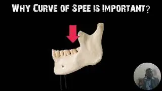 Curves in Occlusion