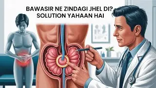 Piles Se Nijaat Ka Sahi Tareeqa | Bawasir Surgery Step by Step