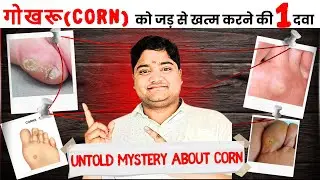 Corn on foot | How to get rid of corn on foot | corn removal