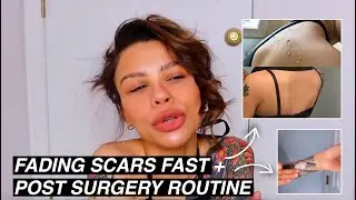 How to fade scars FAST + my post surgery routine