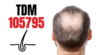 Новое лечение, которое поможет восстановить ваши волосы! TDM 105795