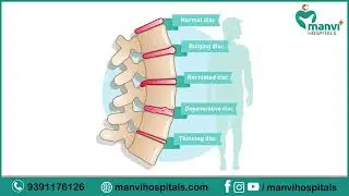 Top Spine Problems Caused by Poor Posture & Mobile Usage | Back Pain Explained in Telugu