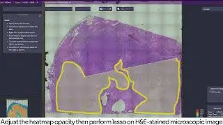 Stereo-seq OMNI for FFPE | Spatial Single-Cell Clustering Tutorial