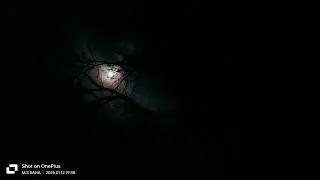 The sound of a fox in the village night