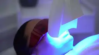 Kosmetische Zahnaufhellung - Zahnbleaching