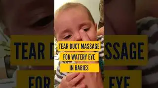 शिशु की आँखों से पानी आना ठीक करने का सही तरीका | | Tear Duct Massage