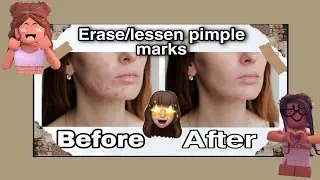 How to erase/lessen pimple marks ( ios+android )