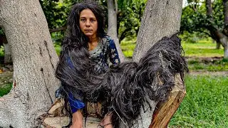 She Was Living Between Trees&hellip; 💔 Her Hair Grew Into a Monster After Years 😱