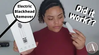 Electric Blackhead Remover | Does it really work?!?