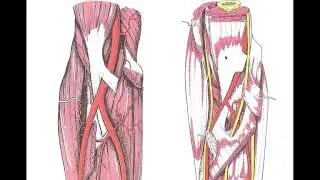 ARTERIAS DEL MIEMBRO SUPERIOR