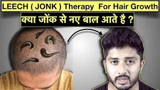 Leech Jonk Therapy for Hair Growth |क्या जोंक से नए बाल आते है ?  | Genuine Tips
