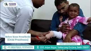 CHILD PROSTHESIS  || Artificial Leg // Leg Training // #fusion #orthotics #artificialleg.
