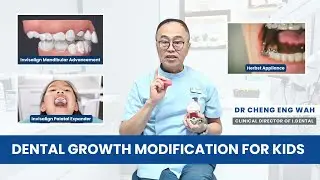 Growth Modification Devices: Guiding Your Child's Jaw Development | i.Dental