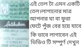 Antibactrin oil review bangla 2021 used in bangla... medicine review bangla