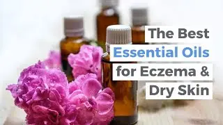 How to Use Essential Oils to Treat Eczema Naturally | The Best Essential Oils for Eczema Treatment