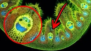 This Things Look So&nbsp;Weird Under a&nbsp;Microscope! Try to Guess