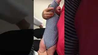 Avo injection