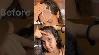 Say goodbye hairfall and hello stronger hair with wow skin science rosemary pro hairgrowth serume#ad