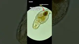 Rotifer Parasites Under Microscope (Bertramia)