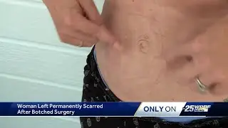 Victim of botched cosmetic surgery in Port St. Lucie urging others to come forward