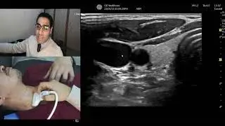 Demonstration of Carotid doppler technique  (Arabic)