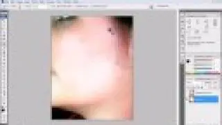How to Remove Acne with Photoshop - MyMediaTutorials.com