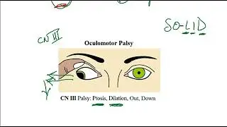 Video 220: Ocular Muscle Innervation & Cranial Nerve Lesions Anatomy, Function & Clinical Correlates