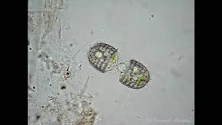 Coleps hirtus   division