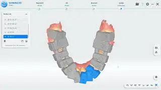 Aoralscan 3 Wireless e Accufab-L4K: Workflow Ottimizzato per Bonding