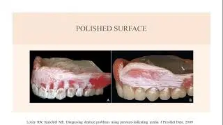 Pressure indicating Paste | Complete Denture| Power Point Presentation